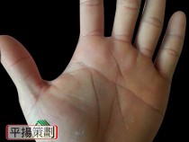 命手同參的案例